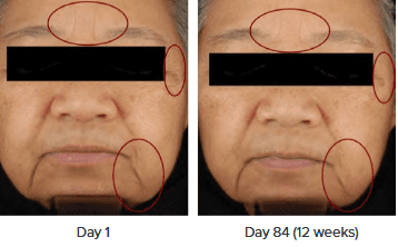 CollagenActiv Study Before And After