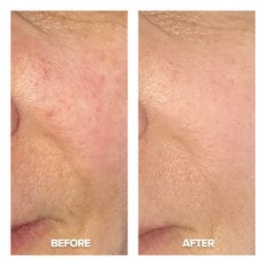 AFA night Cream Before And After